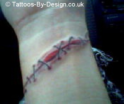 slit wrist stitched up